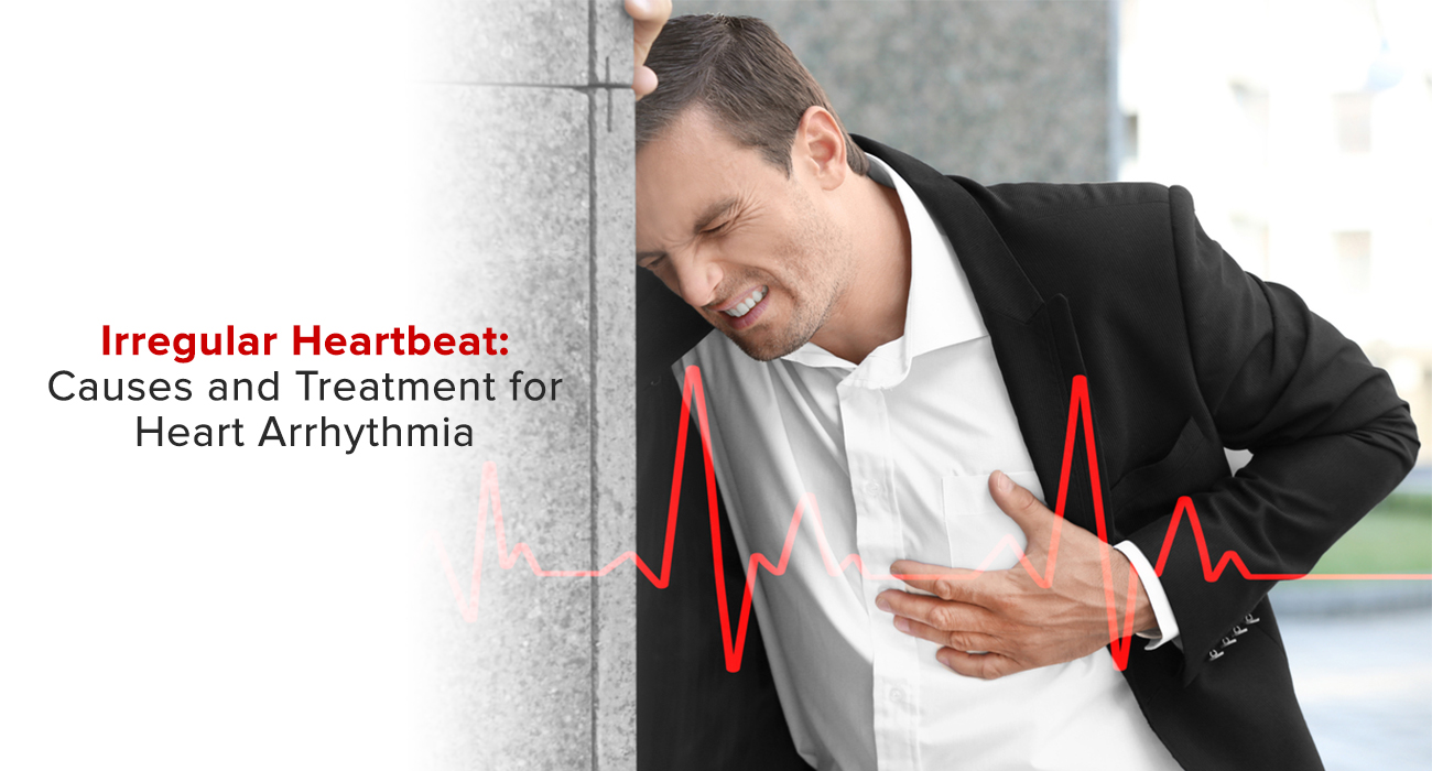 Irregular Heartbeat: Causes and Treatment for Heart Arrhythmia